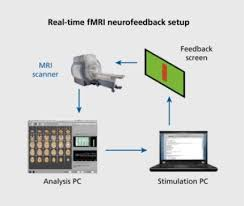 درمان اختلالات خوردن با استانداردسازی نوروفیدبک fMRI