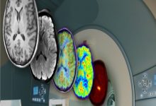 وزن مغز brain weight و میزان گیرنده های عصبی با MRI و PET 2022